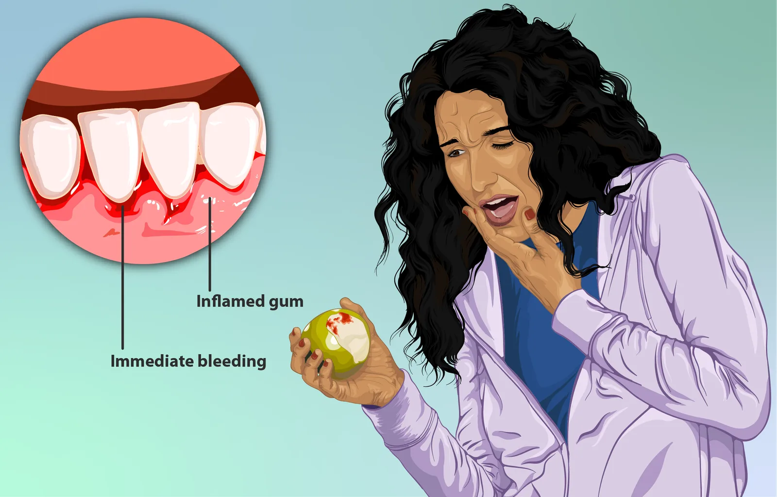Depiction_of_a_woman_with_bleeding_gums_or_gingival_bleeding_or_bleeding_on_probing (1) (1)