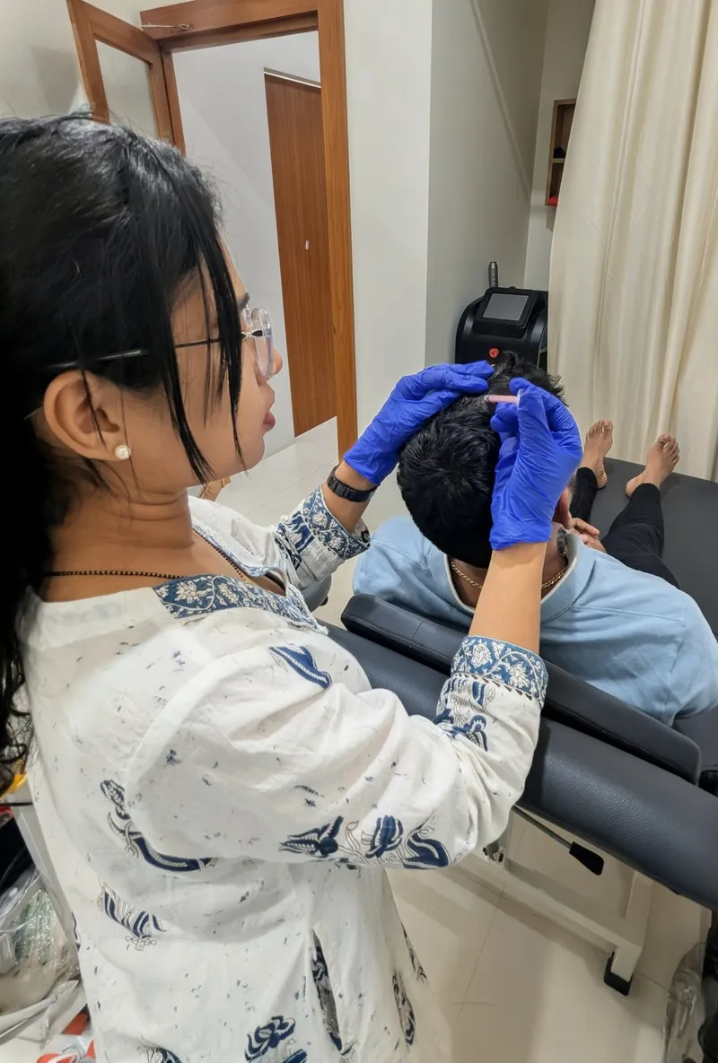 Dr shriya performing GFC growth factor concentrate treatment for hair restoration 1