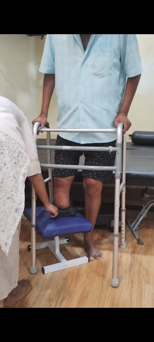 Exercises-for-a-patient-with-a-below-knee-amputation