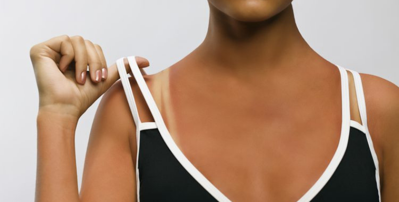 Summer Tan Lines